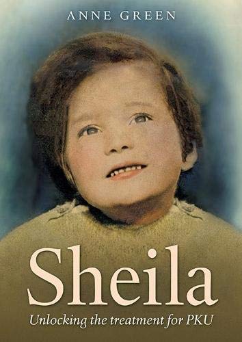 Sheila - Unlocking the treat